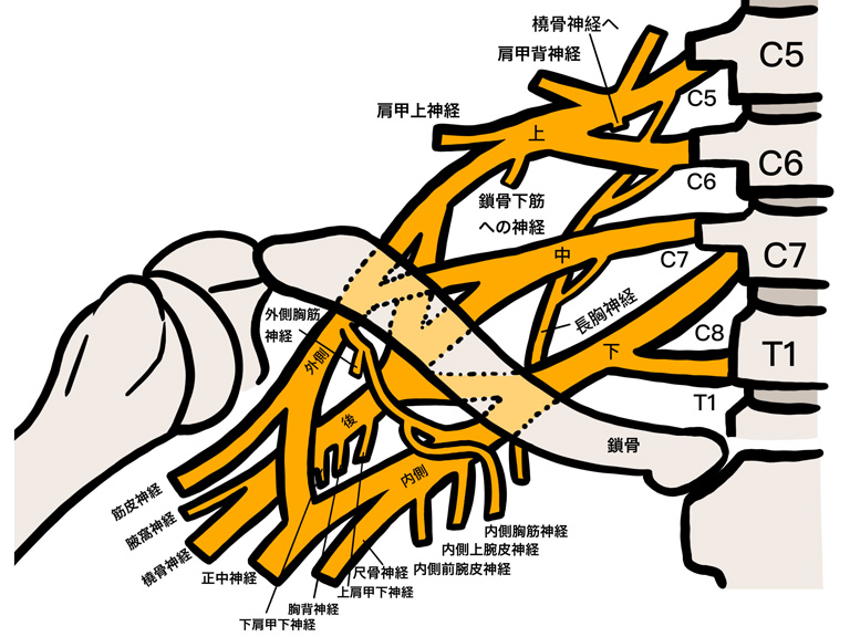 胸郭出口症候群のイメージ