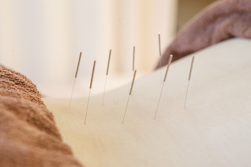 鍼灸・マッサージ